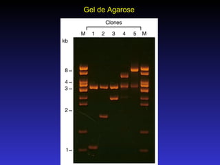 Gel de Agarose 