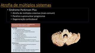 Atrofia de múltiplos sistemas
• Síndrome Parkinson Plus
• Atrofia de múltiplos sistemas (mais comum)
• Paralisia supranuclear progressiva
• Degeneração corticobasal
 