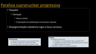 Paralisia supranuclear progressiva
• Taupatia
• Fibrilação
• Menos solúvel
• Propriedade de estabilização-microtubular reduzida
• Despigmentação substância nigra e locus ceruleus
 