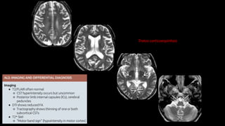 Tratos corticoespinhais
 