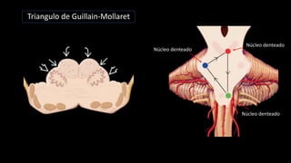 Núcleo denteado
Núcleo denteado
Núcleo denteado
Triangulo de Guillain-Mollaret
 