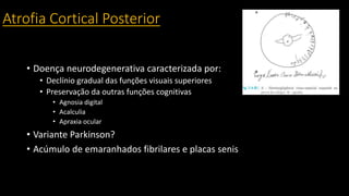 Atrofia Cortical Posterior
• Doença neurodegenerativa caracterizada por:
• Declínio gradual das funções visuais superiores
• Preservação da outras funções cognitivas
• Agnosia digital
• Acalculia
• Apraxia ocular
• Variante Parkinson?
• Acúmulo de emaranhados fibrilares e placas senis
 