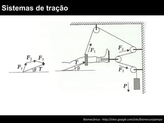 Biomecânica - http://sites.google.com/site/biomecunipampa
Sistemas de tração
 