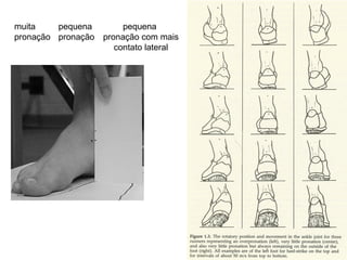 muita
pronação
pequena
pronação
pequena
pronação com mais
contato lateral
 