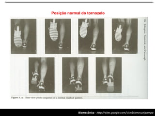 Biomecânica - http://sites.google.com/site/biomecunipampa
Posição normal do tornozelo
 
