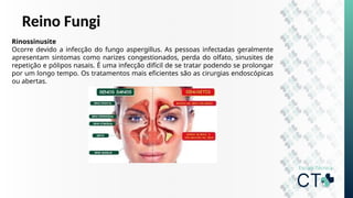 Reino Fungi
Rinossinusite
Ocorre devido a infecção do fungo aspergillus. As pessoas infectadas geralmente
apresentam sintomas como narizes congestionados, perda do olfato, sinusites de
repetição e pólipos nasais. É uma infecção difícil de se tratar podendo se prolongar
por um longo tempo. Os tratamentos mais eficientes são as cirurgias endoscópicas
ou abertas.
 