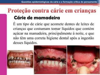 Questões epidemiológicas da cárie e a formação crítica do pensamento
É um tipo de cárie que acomete dentes de leites de
crianças que costumam tomar líquidos que contém
açúcar na mamadeira, principalmente à noite, e que
não têm uma correta higiene dental após a ingestão
desses líquidos.
Cárie de mamadeira
 