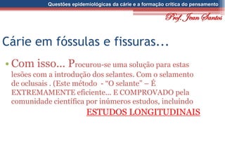 Questões epidemiológicas da cárie e a formação crítica do pensamento
Cárie em fóssulas e fissuras...
• Com isso... Procurou-se uma solução para estas
lesões com a introdução dos selantes. Com o selamento
de oclusais . (Este método - “O selante” – É
EXTREMAMENTE eficiente... E COMPROVADO pela
comunidade científica por inúmeros estudos, incluindo
ESTUDOS LONGITUDINAIS
Prof. Jean Santos
 