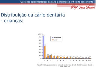 Questões epidemiológicas da cárie e a formação crítica do pensamento
Distribuição da cárie dentária
- crianças:
Prof. Jean Santos
 