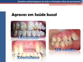 Questões epidemiológicas da cárie e a formação crítica do pensamento
Agravos em Saúde bucal
 