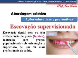 Questões epidemiológicas da cárie e a formação crítica do pensamento
Abordagem coletiva
Ações educativas e preventivas
Escovação dental com ou sem
evidenciação de placa (fucsina),
realizada com grupos
populacionais sob orientação e
supervisão de um ou mais
profissionais de saúde.
Prof. Jean Santos
 