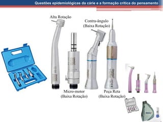 Questões epidemiológicas da cárie e a formação crítica do pensamento
Alta Rotação
Micro-motor
(Baixa Rotação)
Contra-ângulo
(Baixa Rotação)
Peça Reta
(Baixa Rotação)
 
