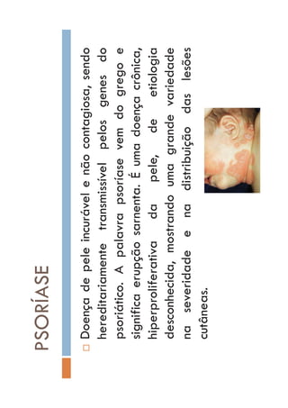 PSORÍASE
…Doençadepeleincurávelenãocontagiosa,sendo
hereditariamentetransmissívelpelosgenesdo
psoriático.Apalavrapsoríasevemdogregoe
significaerupçãosarnenta.Éumadoençacrônica,
hiperproliferativadapele,deetiologia
desconhecida,mostrandoumagrandevariedade
naseveridadeenadistribuiçãodaslesões
cutâneas.
 