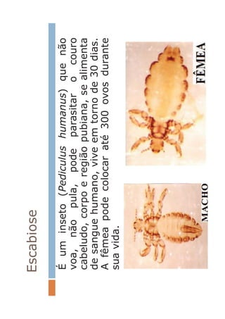 Escabiose
Éuminseto(Pediculushumanus)quenão
voa,nãopula,podeparasitarocouro
cabeludo,corpoeregiãopubiana,sealimenta
desanguehumano,viveemtornode30dias.
Afêmeapodecolocaraté300ovosdurante
suavida.
 