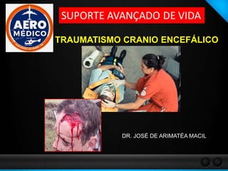TRAUMATISMO CRANIO ENCEFÁLICO
DR. JOSÉ DE ARIMATÉA MACIL
 