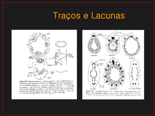 Traços e Lacunas 