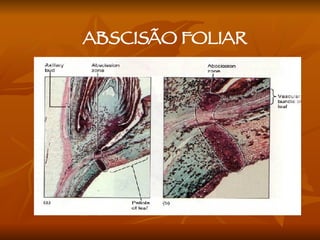 ABSCISÃO FOLIAR 