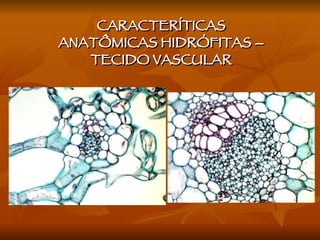 CARACTERÍTICAS ANATÔMICAS HIDRÓFITAS – TECIDO VASCULAR 