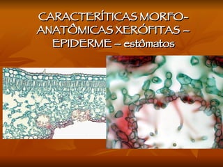 CARACTERÍTICAS MORFO-ANATÔMICAS XERÓFITAS – EPIDERME – estômatos 
