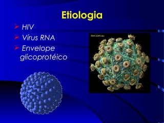 Etiologia
 HIV
 Vírus RNA
 Envelope
glicoprotéico
 