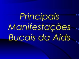 Principais
Manifestações
Bucais da Aids
 