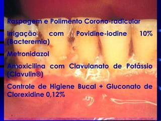 INFECÇÕES BACTERIANAS
 Doença periodontal:
Periodontite marginal crônica
Periodontite ulcerativa necrotizante
Eritema linear gengival
 Lesões ulceradas
 CD4 < 200
Raspagem e Polimento Corono-radicular
Irrigação com Povidine-iodine 10%
(Bacteremia)
Metronidazol
Amoxicilina com Clavulanato de Potássio
(Clavulin®)
Controle de Higiene Bucal + Gluconato de
Clorexidine 0,12%
 