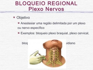 Objetivo
Anestesiar uma região delimitada por um plexo
ou nervo específico
Exemplos: bloqueio plexo braquial, plexo cervical,
bloqueio peridural, bloqueio raquidiano
BLOQUEIO REGIONAL
Plexo Nervos
 