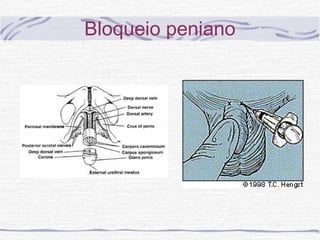 Bloqueio peniano
 
