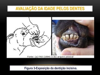 AVALIAÇÃO DA IDADE PELOS DENTES
Figura 3-Exposição da dentição incisiva.
 