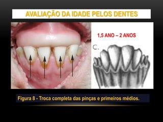 AVALIAÇÃO DA IDADE PELOS DENTES
Figura 8 - Troca completa das pinças e primeiros médios.
1,5 ANO – 2 ANOS
 