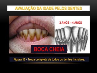 AVALIAÇÃO DA IDADE PELOS DENTES
Figura 10 - Troca completa de todos os dentes incisivos.
3 ANOS – 4 ANOS
BOCA CHEIA
 