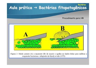 Bactérias

Aula prática  Bactérias fitopatogênicas

                           Procedimento para HR
 
