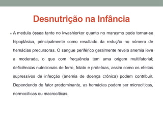 Desnutrição na Infância
• A medula óssea tanto no kwashiorkor quanto no marasmo pode tornar-se
hipoplásica, principalmente como resultado da redução no número de
hemácias precursoras. O sangue periférico geralmente revela anemia leve
a moderada, o que com frequência tem uma origem multifatorial;
deficiências nutricionais de ferro, folato e proteínas, assim como os efeitos
supressivos de infecção (anemia de doença crônica) podem contribuir.
Dependendo do fator predominante, as hemácias podem ser microcíticas,
normocíticas ou macrocíticas.
 