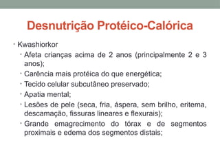 Desnutrição Protéico-Calórica
• Kwashiorkor
• Afeta crianças acima de 2 anos (principalmente 2 e 3
anos);
• Carência mais protéica do que energética;
• Tecido celular subcutâneo preservado;
• Apatia mental;
• Lesões de pele (seca, fria, áspera, sem brilho, eritema,
descamação, fissuras lineares e flexurais);
• Grande emagrecimento do tórax e de segmentos
proximais e edema dos segmentos distais;
 