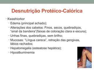 Desnutrição Protéico-Calórica
• Kwashiorkor
• Edema (principal achado);
• Alterações dos cabelos: Finos, secos, quebradiços,
“sinal da bandeira”(faixas de coloração clara e escura);
• Unhas finas, quebradiças, sem brilho;
• Mucosas: “Língua careca”, retração das gengivas,
lábios rachados;
• Hepatomegalia (esteatose hepática);
• Hipoalbuminemia
 