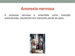 Anorexia nervosa
A anorexia nervosa é entendida como inanição
autoinduzida, resultando em marcante perda de peso.
 