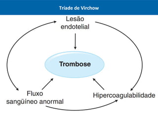 Tríade de Virchow
 