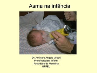Asma na infância
Dr. Amilcare Angelo Vecchi
Pneumologista Infantil
Faculdade de Medicina
UFPEL
 