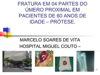 FRATURA EM 04 PARTES DO
ÚMERO PROXIMAL EM
PACIENTES DE 60 ANOS DE
IDADE – PRÓTESE.
MARCELO SOARES DE VITA
HOSPITAL MIGUEL COUTO –
RJ.
 
