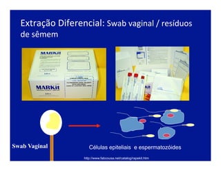http://www.fabcousa.net/catalog/rapekit.htm
Swab Vaginal
Extração	
  Diferencial:	
  Swab	
  vaginal	
  /	
  resíduos	
  
de	
  sêmem	
  
Células epiteliais e espermatozóides
 