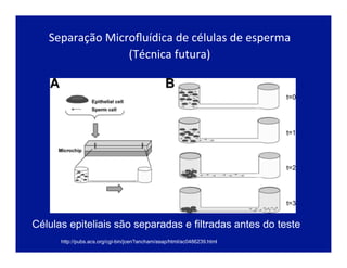  
Separação	
  Microﬂuídica	
  de	
  células	
  de	
  esperma	
  
(Técnica	
  futura)	
  
	
  
Células epiteliais são separadas e filtradas antes do teste
http://pubs.acs.org/cgi-bin/jcen?ancham/asap/html/ac0486239.html
 