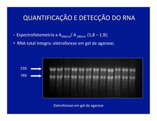 QUANTIFICAÇÃO	
  E	
  DETECÇÃO	
  DO	
  RNA	
  
•  Espectrofotometria	
  a	
  A260nm/	
  A	
  280nm	
  	
  (1,8	
  –	
  1,9);	
  
• 	
  	
  RNA	
  total	
  íntegro:	
  eletroforese	
  em	
  gel	
  de	
  agarose;	
  
23S
16S
	
  Eletroforese	
  em	
  gel	
  de	
  agarose	
  
 