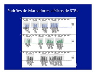 Padrões	
  de	
  Marcadores	
  alélicos	
  de	
  STRs	
  	
  
 