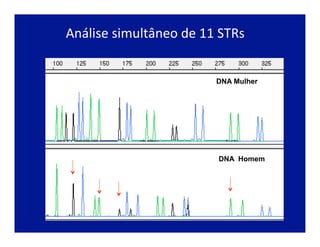 gender
ID
A
B
C
D
E
F
G
H I
J
gender
ID
A
B C D
E
F
G
H
I
J
DNA Size (base pairs)
Análise	
  simultâneo	
  de	
  11	
  STRs	
  
DNA Mulher
DNA Homem
 