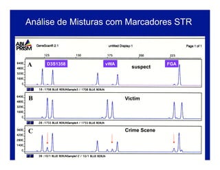D3S1358 vWA FGA
suspect
Victim
Crime Scene
Victim
Suspect
Scene
Análise de Misturas com Marcadores STR
 