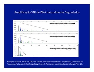  
Ampliﬁcação	
  STR	
  de	
  DNA	
  naturalmente	
  Degradados	
  
	
  
Recuperação	
  de	
  perﬁs	
  de	
  DNA	
  de	
  restos	
  humanos	
  deixados	
  na	
  super~cie	
  (University	
  of	
  
Tennessee’s	
  Forensic	
  Anthropology	
  Center).	
  Amostras	
  ampliﬁcadas	
  com	
  PowerPlex	
  16.	
  
 