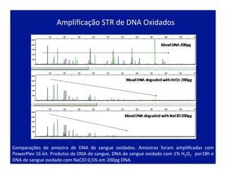  
Ampliﬁcação	
  STR	
  de	
  DNA	
  Oxidados	
  
	
  
Comparações	
   de	
   amostra	
   de	
   DNA	
   de	
   sangue	
   oxidados.	
   Amostras	
   foram	
   ampliﬁcadas	
   com	
  
PowerPlex	
  16	
  kit.	
  Produtos	
  de	
  DNA	
  de	
  sangue,	
  DNA	
  de	
  sangue	
  oxidado	
  com	
  1%	
  H2O2	
  	
  	
  por18h	
  e	
  
DNA	
  de	
  sangue	
  oxidado	
  com	
  NaClO	
  0,5%	
  em	
  200pg	
  DNA.	
  
 
