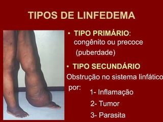 TIPOS DE LINFEDEMA
• TIPO PRIMÁRIO:
congênito ou precoce
(puberdade)
• TIPO SECUNDÁRIO
Obstrução no sistema linfático
por:
2- Tumor
1- Inflamação
3- Parasita
 