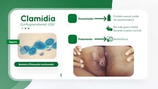(Linfogranuloma) -LGV
Bactéria Chlamydia trachomatis
Esporo
Transmissão
Contato sexual, pode
ser assintomática
Tratamento Antibióticos
Da mãe para o bebê
durante o parto normal
 