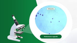 Trichomonas vaginalis
Trofozoítos
 